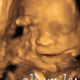 Illustration for article titled Gah! 3D Ultrasound Nightmare Fuel!